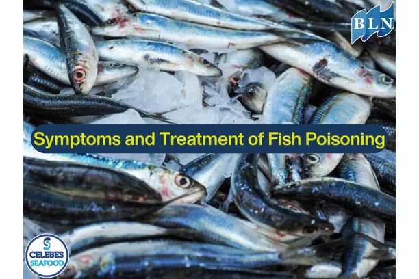 Symptoms and Treatment of Fish Poisoning